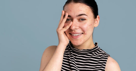 congested skin