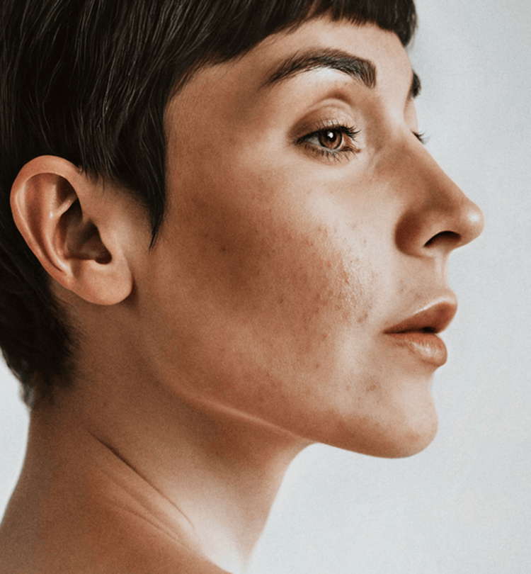Congested & Oily Skin Diagnosis
